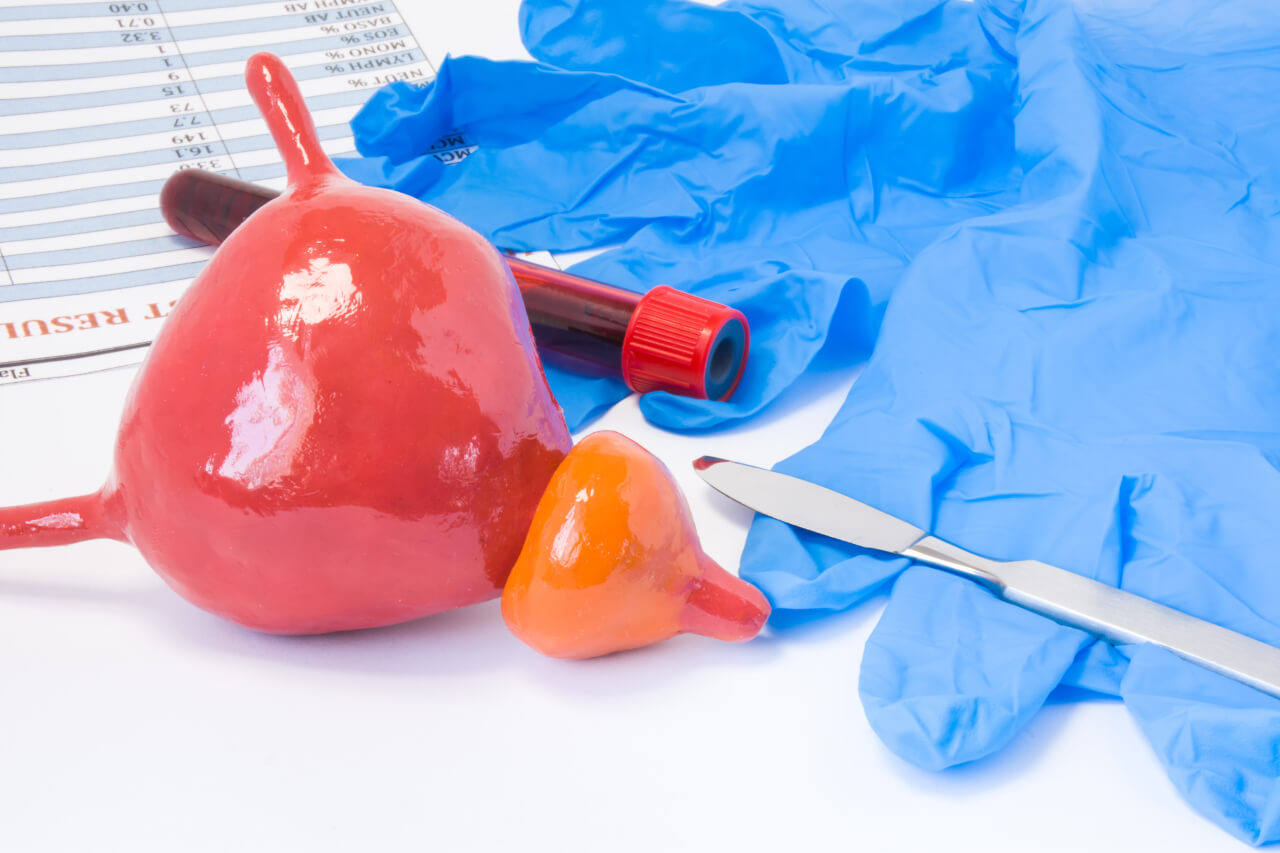 The Tips For Recovery After Prostate Removal