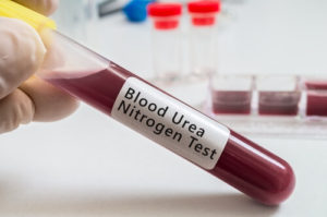 chronic kidney disease stage 2