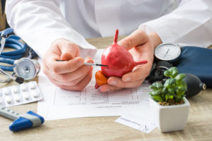 bladder transplantation