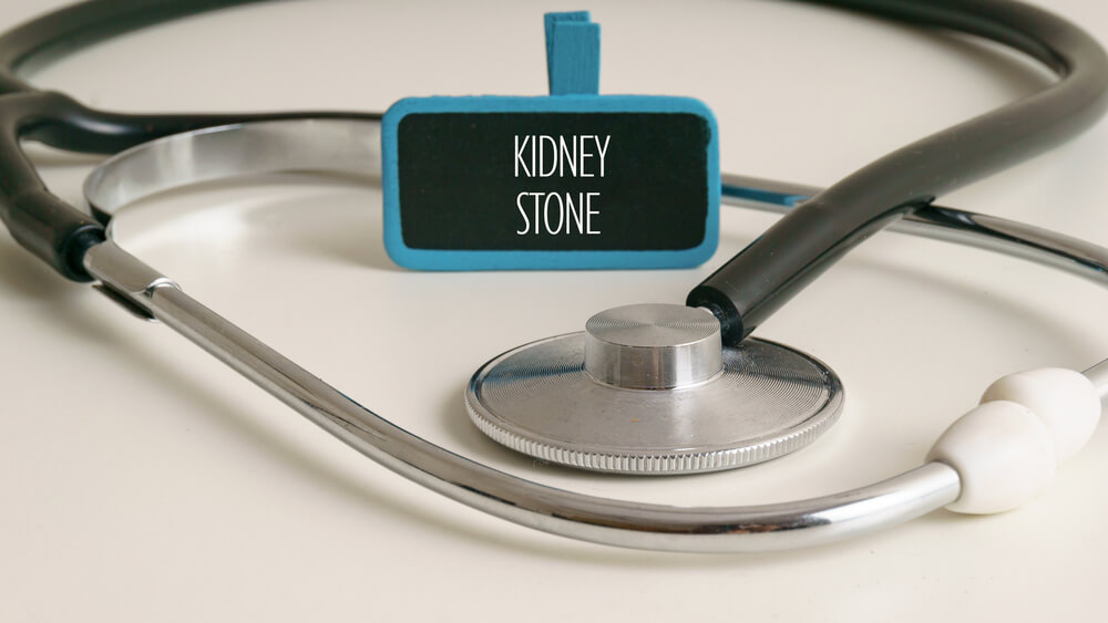 Laser Treatment for Kidney Stones