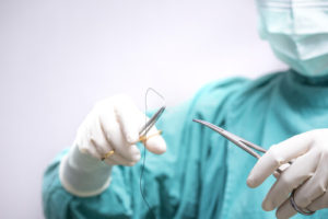 itchy stitches