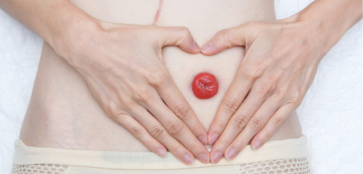 Itchy Stitches After An Ostomy: What Does This Mean?