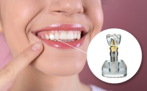 missing tooth government programs